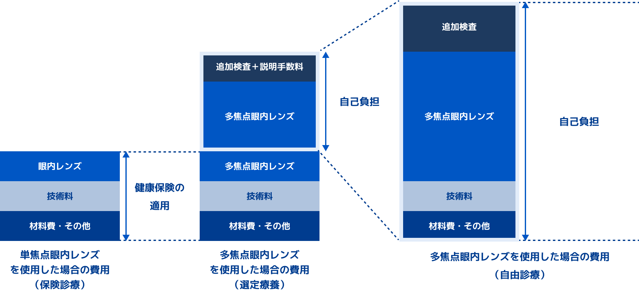 単焦点眼内レンズ
を使用した場合の費用（保険診療）、多焦点眼内レンズを使用した場合の費用（選定療養）、多焦点眼内レンズを使用した場合の費用（自由診療）