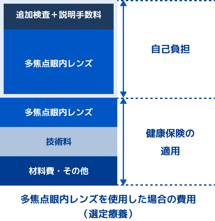多焦点眼内レンズを使用した場合の費用（選定医療）